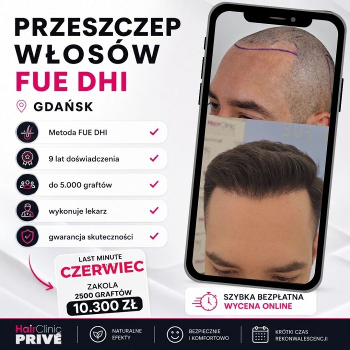 PRZESZCZEP WŁOSÓW FUE (1)