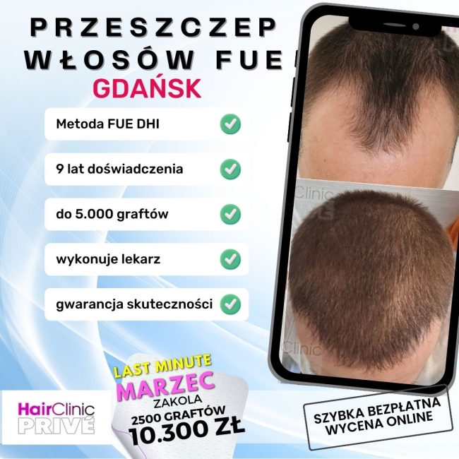 PRZESZCZEP WŁOSÓW FUE (11)