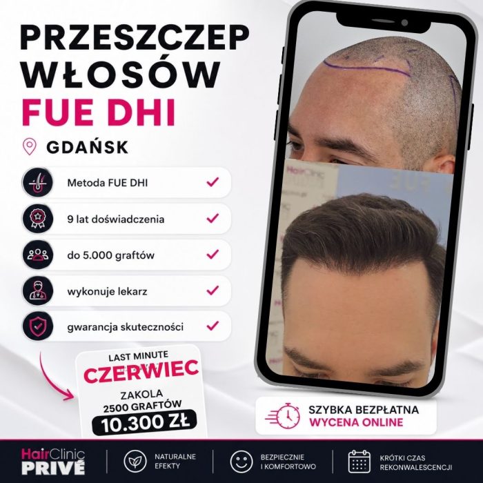 PRZESZCZEP WŁOSÓW FUE
